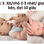 Hút và rửa mũi đúng cách – Phòng Khám KidsCare - BACENI