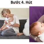 Hút và rửa mũi đúng cách – Phòng Khám KidsCare - BACENI