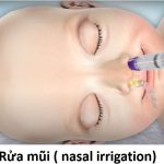 Hút và rửa mũi đúng cách – Phòng Khám KidsCare - BACENI